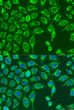Immunofluorescence analysis of U2OS cells using MATN3 Rabbit pAb (STJ117266) at dilution of 1:100. Secondary antibody: Cy3-conjugated Goat anti-Rabbit IgG (H+L) (STJS001166) at 1:500 dilution. Blue: DAPI for nuclear staining.
