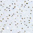 Immunohistochemistry analysis of SOX10 in paraffin-embedded rat brain using SOX10 Rabbit polyclonal antibody (STJ117294) at dilution of 1:100 (40x lens). Perform high pressure antigen retrieval with 10 mM citrate buffer pH 6. 0 before commencing with immunohistochemistry staining protocol.