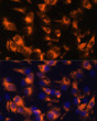 Immunofluorescence analysis of C6 cells using Somatostatin Receptor 2 (SSTR2) Rabbit polyclonal antibody (STJ117295) at dilution of 1:100 (40x lens). Secondary antibody: Cy3 Goat Anti-Rabbit IgG (H+L) at 1:500 dilution. Blue: DAPI for nuclear staining.