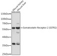 Western blot analysis of various lysates using Somatostatin Receptor 2 (SSTR2) Rabbit polyclonal antibody (STJ117295) at 1:1000 dilution. Secondary antibody: HRP Goat Anti-Rabbit IgG (H+L) (STJS000856) at 1:10000 dilution. Lysates/proteins: 25 Mu g per lane. Blocking buffer: 3% nonfat dry milk in TBST. Detection: ECL Enhanced Kit. Exposure time: 30s.