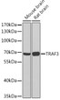 Western blot analysis of extracts of various cell lines, using TRAF3 Rabbit polyclonal antibody (STJ117300) at 1:1000 dilution. Secondary antibody: HRP Goat Anti-Rabbit IgG (H+L) (STJS000856) at 1:10000 dilution. Lysates/proteins: 25 Mu g per lane. Blocking buffer: 3% nonfat dry milk in TBST. Detection: ECL Basic Kit. Exposure time: 90s.