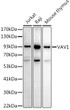 Western blot analysis of extracts of various cell lines, using VAV1 antibody (STJ117302) at 1:1000 dilution. Secondary antibody: HRP Goat Anti-Rabbit IgG (H+L) (STJS000856) at 1:10000 dilution. Lysates/proteins: 25 Mu g per lane. Blocking buffer: 3% nonfat dry milk in TBST. Detection: ECL Basic Kit. Exposure time: 180s.
