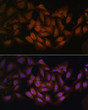 Immunofluorescence analysis of U-2 OS cells using CNBP Rabbit polyclonal antibody (STJ117304) at dilution of 1:100. Secondary antibody: Cy3 Goat Anti-Rabbit IgG (H+L) at 1:500 dilution. Blue: DAPI for nuclear staining.