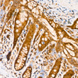 Immunohistochemistry analysis of CNBP in paraffin-embedded Rat colon tissue using CNBP Rabbit polyclonal antibody (STJ117304) at a dilution of 1:100 (40x lens). High pressure antigen retrieval was performed with 0. 01 M citrate buffer (pH 6. 0) prior to immunohistochemistry staining.