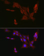 Immunofluorescence analysis of PC-12 cells using EIF4ENIF1 Rabbit polyclonal antibody (STJ117369) at dilution of 1:100 (40x lens). Secondary antibody: Cy3 Goat Anti-Rabbit IgG (H+L) at 1:500 dilution. Blue: DAPI for nuclear staining.