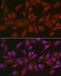 Immunofluorescence analysis of NIH/3T3 cells using EIF4ENIF1 Rabbit polyclonal antibody (STJ117369) at dilution of 1:100 (40x lens). Secondary antibody: Cy3 Goat Anti-Rabbit IgG (H+L) at 1:500 dilution. Blue: DAPI for nuclear staining.