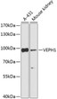 Western blot analysis of extracts of various cell lines, using VEPH1 Antibody (STJ117422) at 1:1000 dilution. Secondary antibody: HRP Goat Anti-Rabbit IgG (H+L) (STJS000856) at 1:10000 dilution. Lysates/proteins: 25 Mu g per lane. Blocking buffer: 3% nonfat dry milk in TBST. Detection: ECL Enhanced Kit. Exposure time: 5s.