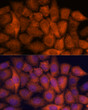 Immunofluorescence analysis of HeLa cells using RPAP3 Rabbit polyclonal antibody (STJ117433) at dilution of 1:100. Secondary antibody: Cy3 Goat Anti-Rabbit IgG (H+L) at 1:500 dilution. Blue: DAPI for nuclear staining.