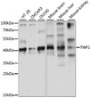 Western blot analysis of various lysates using TWF1 Rabbit polyclonal antibody (STJ117502) at 1:1000 dilution. Secondary antibody: HRP Goat Anti-Rabbit IgG (H+L) (STJS000856) at 1:10000 dilution. Lysates/proteins: 25 Mu g per lane. Blocking buffer: 3% nonfat dry milk in TBST. Detection: ECL Basic Kit. Exposure time: 1s.