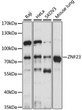 Western blot analysis of various lysates using ZNF23 Rabbit polyclonal antibody (STJ117524) at 1:1000 dilution. Secondary antibody: HRP Goat Anti-Rabbit IgG (H+L) (STJS000856) at 1:10000 dilution. Lysates/proteins: 25 Mu g per lane. Blocking buffer: 3% nonfat dry milk in TBST. Detection: ECL Basic Kit. Exposure time: 10s.