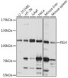 Western blot analysis of various lysates using FIG4 Rabbit polyclonal antibody (STJ117567) at 1:1000 dilution. Secondary antibody: HRP Goat Anti-Rabbit IgG (H+L) (STJS000856) at 1:10000 dilution. Lysates/proteins: 25 Mu g per lane. Blocking buffer: 3% nonfat dry milk in TBST. Detection: ECL Basic Kit. Exposure time: 30s.