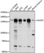 Western blot analysis of various lysates using SUGP2 Rabbit polyclonal antibody (STJ117573) at 1:1000 dilution. Secondary antibody: HRP Goat Anti-Rabbit IgG (H+L) (STJS000856) at 1:10000 dilution. Lysates/proteins: 25 Mu g per lane. Blocking buffer: 3% nonfat dry milk in TBST. Detection: ECL Basic Kit. Exposure time: 5s.