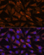 Immunofluorescence analysis of L929 cells using LMAN2 Rabbit polyclonal antibody (STJ117589) at dilution of 1:100. Secondary antibody: Cy3 Goat Anti-Rabbit IgG (H+L) at 1:500 dilution. Blue: DAPI for nuclear staining.