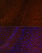 Immunofluorescence analysis of paraffin-embedded mouse brain using RUSC1 Rabbit polyclonal antibody (STJ117612) at dilution of 1:100. Secondary antibody: Cy3 Goat Anti-Rabbit IgG (H+L) at 1:500 dilution. Blue: DAPI for nuclear staining.