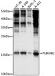 Western blot analysis of various lysates using PLEKHB2 Rabbit polyclonal antibody (STJ117657) at 1:1000 dilution. Secondary antibody: HRP Goat Anti-Rabbit IgG (H+L) (STJS000856) at 1:10000 dilution. Lysates/proteins: 25 Mu g per lane. Blocking buffer: 3% nonfat dry milk in TBST. Detection: ECL Basic Kit. Exposure time: 30s.