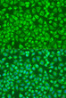 Immunofluorescence analysis of U2OS cells using ENTPD5 Rabbit pAb (STJ117847) at dilution of 1:100. Secondary antibody: Cy3-conjugated Goat anti-Rabbit IgG (H+L) (STJS001166) at 1:500 dilution. Blue: DAPI for nuclear staining.