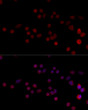 Immunofluorescence analysis of 293T cells using HNRPH3 Rabbit pAb (STJ117860) at dilution of 1:100 (40x lens). Secondary antibody: Cy3-conjugated Goat anti-Rabbit IgG (H+L) (STJS001166) at 1:500 dilution. Blue: DAPI for nuclear staining.
