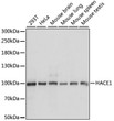 Western blot analysis of various lysates using HACE1 Rabbit pAb (STJ117867) at 1:1000 dilution. <br/>Secondary antibody: HRP-conjugated Goat anti-Rabbit IgG (H+L) (STJS000856) at 1:10000 dilution. <br/>Lysates/proteins: 25 Mu g per lane. <br/>Blocking buffer: 3% nonfat dry milk in TBST. <br/>Detection: ECL Basic Kit <br/>Exposure time: 10s.