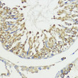 Immunohistochemistry analysis of paraffin-embedded Rat testis using HACE1 Rabbit pAb (STJ117867) at dilution of 1:100 (40x lens). Microwave antigen retrieval performed with 0. 01M PBS Buffer (pH 7. 2) prior to immunohistochemistry staining.