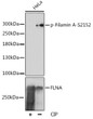 Western blot analysis of lysates from HeLa cells, using Phospho-Filamin A-S2152 pAb (STJ117881) at 1:1000 dilution or Filamin A antibody (STJ110205). Hela cell lysate were treated by CIP (20ul CIP for each 400ul cell lysate) at 37 °C for 1 hour. <br/>Secondary antibody: HRP-conjugated Goat anti-Rabbit IgG (H+L) (STJS000856) at 1:10000 dilution. <br/>Lysates/proteins: 25 Mu g per lane. <br/>Blocking buffer: 3% BSA. <br/>Detection: ECL Enhanced Kit <br/>Exposure time: 30s.