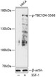 Western blot analysis of lysates from HeLa cells, using Phospho-TBC1D4-S588 Rabbit pAb (STJ117888) at 1:2000 dilution. HeLa cells were treated by IGF-1 (50ng/mL) for 30 minutes after serum-starvation overnight. <br/>Secondary antibody: HRP-conjugated Goat anti-Rabbit IgG (H+L) (STJS000856) at 1:10000 dilution. <br/>Lysates/proteins: 25 Mu g per lane. <br/>Blocking buffer: 3% BSA. <br/>Detection: ECL Basic Kit <br/>Exposure time: 30s.