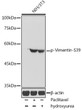 Western blot analysis of lysates from NIH/3T3 cells, using Phospho-Vimentin-S39 Rabbit pAb (STJ117904) at 1:1000 dilution. NIH/3T3 cells were treated by Paclitaxel (100 nM/ml) at 37 °C for 20 hours. NIH/3T3 cells were treated by Hydroxyurea (4 mM) at 37 °C for 20 hours. <br/>Secondary antibody: HRP-conjugated Goat anti-Rabbit IgG (H+L) (STJS000856) at 1:10000 dilution. <br/>Lysates/proteins: 25 Mu g per lane. <br/>Blocking buffer: 3% nonfat dry milk in TBST. <br/>Detection: ECL Enhanced Kit <br/>Exposure time: 1s.