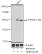 Western blot analysis of lysates from HeLa cells, using Phospho-Vimentin-S39 Rabbit pAb (STJ117904) at 1:1000 dilution. HeLa cells were treated by Paclitaxel (100 nM/ml) at 37 °C for 20 hours. HeLa cells were treated by Hydroxyurea (4 mM) at 37 °C for 20 hours. <br/>Secondary antibody: HRP-conjugated Goat anti-Rabbit IgG (H+L) (STJS000856) at 1:10000 dilution. <br/>Lysates/proteins: 25 Mu g per lane. <br/>Blocking buffer: 3% nonfat dry milk in TBST. <br/>Detection: ECL Basic Kit <br/>Exposure time: 180s.