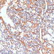 Immunohistochemistry analysis of paraffin-embedded Human appendix using Phospho-Vimentin-S39 Rabbit pAb (STJ117904) at dilution of 1:100 (40x lens). Microwave antigen retrieval performed with 0. 01M Tris/EDTA Buffer (pH 9. 0) prior to immunohistochemistry staining.