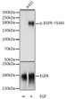 Western blot analysis of lysates from A-431 cells, using Phospho-EGFR-Y1045 Rabbit pAb (STJ117917) at 1:1000 dilution or EGFR antibody (STJ234591). A-431 cells were treated by EGF (100 ng/mL) at 37 °C for 30 minutes after serum-starvation overnight. <br/>Secondary antibody: HRP-conjugated Goat anti-Rabbit IgG (H+L) (STJS000856) at 1:10000 dilution. <br/>Lysates/proteins: 25 Mu g per lane. <br/>Blocking buffer: 3% BSA. <br/>Detection: ECL Basic Kit <br/>Exposure time: 1s.