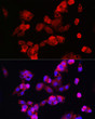 Immunofluorescence analysis of HepG2 cells using CYP7A1 Rabbit polyclonal antibody (STJ118006) at dilution of 1:100 (40x lens). Blue: DAPI for nuclear staining.