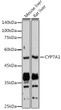 Western blot analysis of extracts of various cell lines, using CYP7A1 antibody (STJ118006) at 1:1000 dilution. Secondary antibody: HRP Goat Anti-Rabbit IgG (H+L) (STJS000856) at 1:10000 dilution. Lysates/proteins: 25 Mu g per lane. Blocking buffer: 3% nonfat dry milk in TBST. Detection: ECL Basic Kit. Exposure time: 10s.