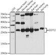 Western blot analysis of various lysates using GSTT2 Rabbit polyclonal antibody (STJ118124) at 1:1000 dilution. Secondary antibody: HRP Goat Anti-Rabbit IgG (H+L) (STJS000856) at 1:10000 dilution. Lysates/proteins: 25 Mu g per lane. Blocking buffer: 3% nonfat dry milk in TBST. Detection: ECL Basic Kit. Exposure time: 5s.
