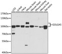 Western blot analysis of various lysates using GOLGA5 Rabbit polyclonal antibody (STJ118213) at 1:1000 dilution. Secondary antibody: HRP Goat Anti-Rabbit IgG (H+L) (STJS000856) at 1:10000 dilution. Lysates/proteins: 25 Mu g per lane. Blocking buffer: 3% nonfat dry milk in TBST. Detection: ECL Basic Kit. Exposure time: 60s.