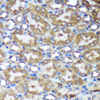 Immunohistochemistry analysis of ACTR1B in paraffin-embedded Mouse kidney using ACTR1B Rabbit polyclonal antibody (STJ118218) at dilution of 1:100 (40x lens). Perform microwave antigen retrieval with 10 mM PBS buffer pH 7. 2 before commencing with immunohistochemistry staining protocol.