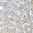 Immunohistochemistry analysis of UNC13B in paraffin-embedded Human liver using UNC13B Rabbit polyclonal antibody (STJ118225) at dilution of 1:100 (40x lens). Perform microwave antigen retrieval with 10 mM PBS buffer pH 7. 2 before commencing with immunohistochemistry staining protocol.