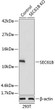 Western blot analysis of lysates from wild type (WT) and SEC61B knockout (KO) 293T cells, using [KO Validated] SEC61B Rabbit polyclonal antibody (STJ118233) at 1:1000 dilution. Secondary antibody: HRP Goat Anti-Rabbit IgG (H+L) (STJS000856) at 1:10000 dilution. Lysates/proteins: 25 Mu g per lane. Blocking buffer: 3% nonfat dry milk in TBST. Detection: ECL Basic Kit. Exposure time: 1s.