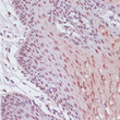 Immunohistochemistry analysis of KDM1 in paraffin-embedded human esophageal using KDM1 Rabbit polyclonal antibody (STJ118239) at dilution of 1:100 (40x lens). Perform microwave antigen retrieval with 10 mM PBS buffer pH 7. 2 before commencing with immunohistochemistry staining protocol.