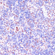 Immunohistochemistry analysis of KDM1 in paraffin-embedded rat spleen using KDM1 Rabbit polyclonal antibody (STJ118239) at dilution of 1:100 (40x lens). Perform microwave antigen retrieval with 10 mM PBS buffer pH 7. 2 before commencing with immunohistochemistry staining protocol.