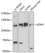 Western blot analysis of various lysates using KDM1 Rabbit polyclonal antibody (STJ118239) at 1:1000 dilution. Secondary antibody: HRP Goat Anti-Rabbit IgG (H+L) (STJS000856) at 1:10000 dilution. Lysates/proteins: 25 Mu g per lane. Blocking buffer: 3% nonfat dry milk in TBST. Detection: ECL Basic Kit. Exposure time: 90s.