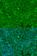 Immunofluorescence analysis of U2OS cells using DICER1 antibody (STJ118244) at dilution of 1:100. Blue: DAPI for nuclear staining.