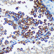 Immunohistochemistry analysis of RABGAP1 in paraffin-embedded Mouse testis using RABGAP1 Rabbit polyclonal antibody (STJ118249) at dilution of 1:100 (40x lens). Perform microwave antigen retrieval with 10 mM PBS buffer pH 7. 2 before commencing with immunohistochemistry staining protocol. Immunohistochemistry analysis of RABGAP1 in paraffin-embedded Mouse testis using RABGAP1 Rabbit polyclonal antibody (STJ118249) at dilution of 1:100 (40x lens). Perform microwave antigen retrieval with 10 mM PBS buffer pH 7. 2 before commencing with immunohistochemistry staining protocol.