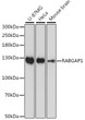 Western blot analysis of various lysates using RABGAP1 Rabbit polyclonal antibody (STJ118249) at 1:1000 dilution. Secondary antibody: HRP Goat Anti-Rabbit IgG (H+L) (STJS000856) at 1:10000 dilution. Lysates/proteins: 25 Mu g per lane. Blocking buffer: 3% nonfat dry milk in TBST. Detection: ECL Basic Kit. Exposure time: 90s. Western blot analysis of various lysates using RABGAP1 Rabbit polyclonal antibody (STJ118249) at 1:1000 dilution. Secondary antibody: HRP Goat Anti-Rabbit IgG (H+L) (STJS000856) at 1:10000 dilution. Lysates/proteins: 25 Mu g per lane. Blocking buffer: 3% nonfat dry milk in TBST. Detection: ECL Basic Kit. Exposure time: 90s.