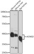 Western blot analysis of various lysates using ACMSD Rabbit polyclonal antibody (STJ118398) at 1:1000 dilution. Secondary antibody: HRP Goat Anti-Rabbit IgG (H+L) (STJS000856) at 1:10000 dilution. Lysates/proteins: 25 Mu g per lane. Blocking buffer: 3% nonfat dry milk in TBST. Detection: ECL Basic Kit. Exposure time: 10s.
