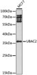 Western blot analysis of lysates from MCF7 cells, using UBAC2 Rabbit polyclonal antibody (STJ118420) at 1:1000 dilution. Secondary antibody: HRP Goat Anti-Rabbit IgG (H+L) (STJS000856) at 1:10000 dilution. Lysates/proteins: 25 Mu g per lane. Blocking buffer: 3% nonfat dry milk in TBST. Detection: ECL Basic Kit. Exposure time: 90s. Western blot analysis of lysates from MCF7 cells, using UBAC2 Rabbit polyclonal antibody (STJ118420) at 1:1000 dilution. Secondary antibody: HRP Goat Anti-Rabbit IgG (H+L) (STJS000856) at 1:10000 dilution. Lysates/proteins: 25 Mu g per lane. Blocking buffer: 3% nonfat dry milk in TBST. Detection: ECL Basic Kit. Exposure time: 90s.