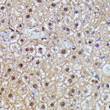 Immunohistochemistry analysis of IGHMBP2 in paraffin-embedded mouse liver using IGHMBP2 Rabbit polyclonal antibody (STJ118494) at dilution of 1:100 (40x lens). Perform microwave antigen retrieval with 10 mM PBS buffer pH 7. 2 before commencing with immunohistochemistry staining protocol.