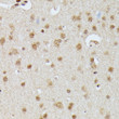 Immunohistochemistry analysis of IGHMBP2 in paraffin-embedded rat brain using IGHMBP2 Rabbit polyclonal antibody (STJ118494) at dilution of 1:100 (40x lens). Perform microwave antigen retrieval with 10 mM PBS buffer pH 7. 2 before commencing with immunohistochemistry staining protocol.
