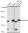 Western blot analysis of various lysates using IGHMBP2 Rabbit polyclonal antibody (STJ118494) at 1:1000 dilution. Secondary antibody: HRP Goat Anti-Rabbit IgG (H+L) (STJS000856) at 1:10000 dilution. Lysates/proteins: 25 Mu g per lane. Blocking buffer: 3% nonfat dry milk in TBST. Detection: ECL Basic Kit. Exposure time: 60s.