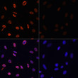 Immunofluorescence analysis of NIH/3T3 cells using Acetyl-Histone H3-K36 Rabbit polyclonal antibody (STJ118517) at dilution of 1:100. NIH/3T3 cells were treated by TSA (1 uM) at 37 °C for 18 hours. Blue: DAPI for nuclear staining.
