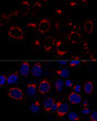 Confocal immunofluorescence analysis of HeLa cells using USO1 Polyclonal Antibody (STJ118519) at dilution of 1:50. Blue: DAPI for nuclear staining.