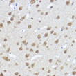 Immunohistochemistry analysis of MYOCD in paraffin-embedded Rat brain using MYOCD Rabbit polyclonal antibody (STJ118599) at dilution of 1:100 (40x lens). Perform high pressure antigen retrieval with 10 mM citrate buffer pH 6. 0 before commencing with immunohistochemistry staining protocol.